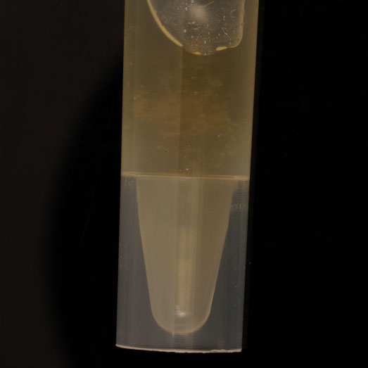 Koffeinhaltige Flüssigkeit, erworben als MDMA haltige Lösung, 16.01.2024 (Berlin)