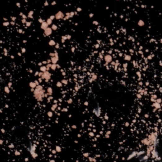 2C-B mit unbekannter Substanz, 04.07.2023 (Berlin)